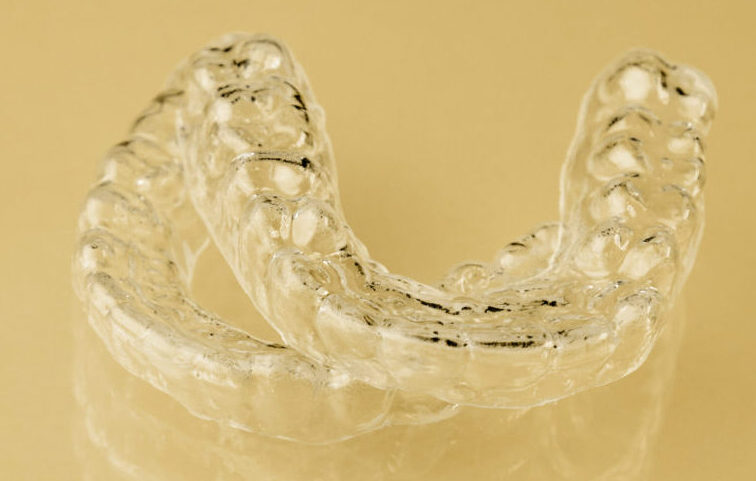 Eine Invisalign Zahnschiene für gerade Zähne